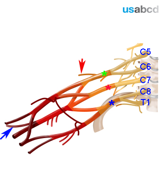 Brachial_plexus_nerve