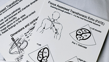Fatecard in pocket 374x210 FATE course – Basic Cardiac Ultrasound course