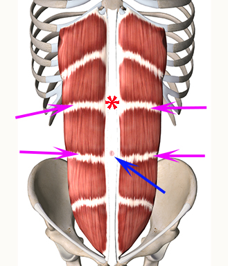藍色箭頭：腹直肌的白線 Linea alba紫色箭頭：橫向的肌肉腱鞘